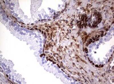 Immunohistochemistry: Glutathione S-Transferase pi 1/GSTP1 Antibody (OTI4B6) [NBP2-45916]