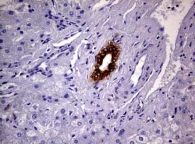 Immunohistochemistry: Glutathione S-Transferase pi 1/GSTP1 Antibody (OTI4B6) [NBP2-45916]