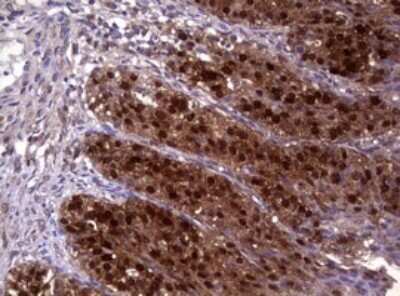 Immunohistochemistry: Glutathione S-Transferase pi 1/GSTP1 Antibody (OTI4B6) - Azide and BSA Free [NBP2-70857]