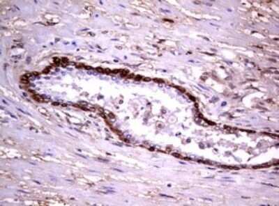 Immunohistochemistry: Glutathione S-Transferase pi 1/GSTP1 Antibody (OTI4B6) - Azide and BSA Free [NBP2-70857]
