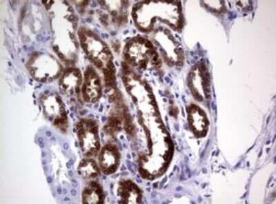 Immunohistochemistry: Glutathione S-Transferase pi 1/GSTP1 Antibody (OTI4B6) - Azide and BSA Free [NBP2-70857]