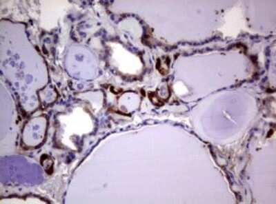 Immunohistochemistry: Glutathione S-Transferase pi 1/GSTP1 Antibody (OTI4B6) - Azide and BSA Free [NBP2-70857]