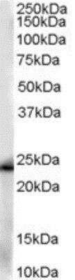 Western Blot: Glutathione S-Transferase pi 1/GSTP1 Antibody [NB100-1792]