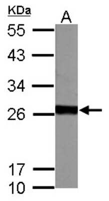 Western Blot: Glutathione S-transferase Mu 5 Antibody [NBP1-32682]