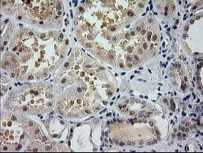 Immunohistochemistry-Paraffin: Glutathione Synthetase Antibody (OTI1B8) [NBP2-03351]