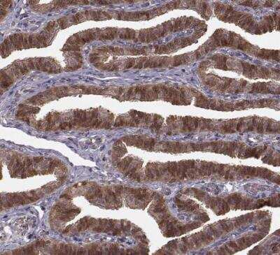 Immunohistochemistry-Paraffin: Glutathione Synthetase Antibody [NBP2-30465]