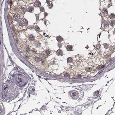 Immunohistochemistry-Paraffin: Glutathione Synthetase Antibody [NBP2-57177]