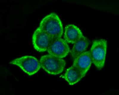 Immunocytochemistry/ Immunofluorescence: Glutathione Synthetase Antibody (JB95-33) [NBP2-75513]
