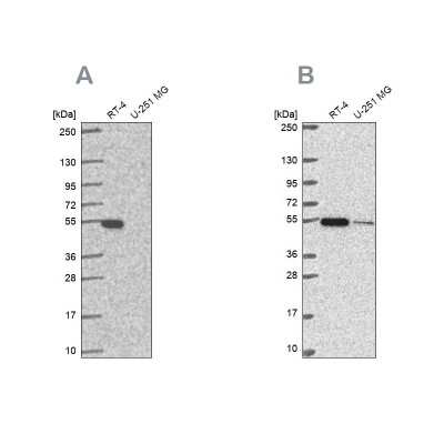 Western Blot: Glutathione Synthetase Antibody [NBP2-57177]