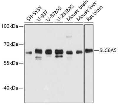 Western Blot: GlyT2/SLC6A5 AntibodyAzide and BSA Free [NBP3-03334]