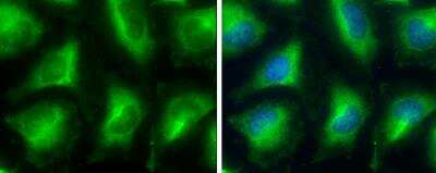Immunocytochemistry/ Immunofluorescence: Glycerol 3 Phosphate Dehydrogenase Antibody [NBP2-16688]