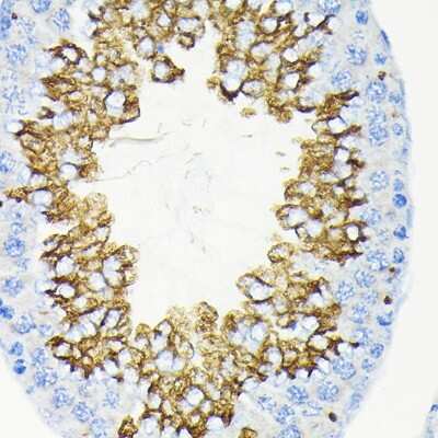 Immunohistochemistry-Paraffin: Glycerol Kinase Antibody (8S4T8) [NBP3-15687]