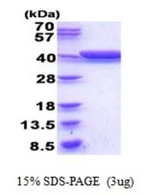 SDS-PAGE: Recombinant E. coli Glycerol dehydrogenase His Protein [NBP2-51836]