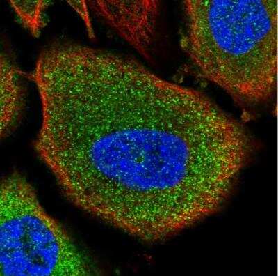 Immunocytochemistry/ Immunofluorescence: Glycogen Phosphorylase BB/GPBB Antibody [NBP2-47446]