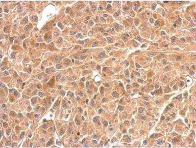 Immunohistochemistry-Paraffin: Glycogen Phosphorylase BB/GPBB Antibody [NBP1-32799]