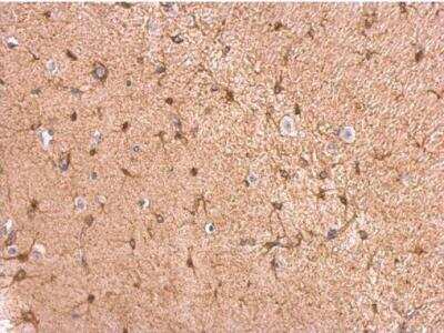 Immunohistochemistry-Paraffin: Glycogen Phosphorylase BB/GPBB Antibody [NBP1-32799]
