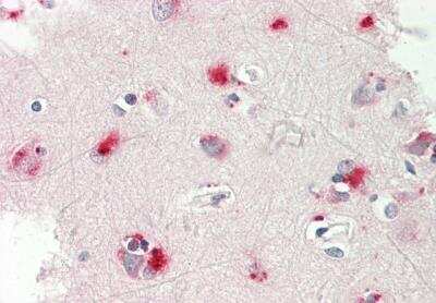 Immunohistochemistry-Paraffin: Glycogen Phosphorylase BB/GPBB Antibody [NBP1-54940]