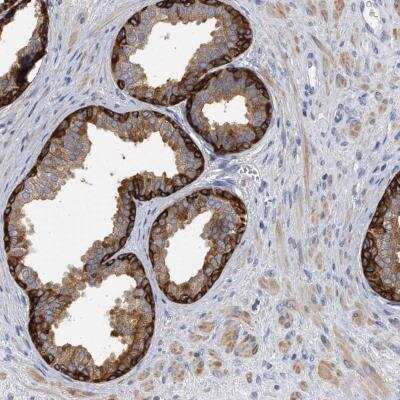 Immunohistochemistry-Paraffin: Glycogen Phosphorylase BB/GPBB Antibody [NBP2-47446]