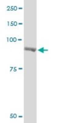 Western Blot: Glycogen phosphorylase, muscle form Antibody (2C4) [H00005837-M10]