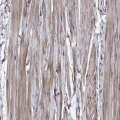 Immunohistochemistry-Paraffin: Glycogenin 1 Antibody [NBP3-17719]