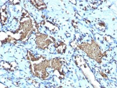 Immunohistochemistry-Paraffin: Glycophorin A Antibody (GYPA/1725R) [NBP2-53136]