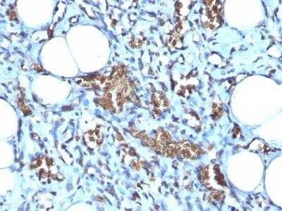 Immunohistochemistry-Paraffin: Glycophorin A Antibody (GYPA/280) - Azide and BSA Free [NBP2-47718]