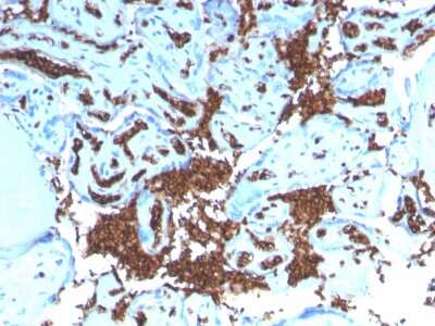 Immunohistochemistry-Paraffin: Glycophorin A Antibody (GYPA/3219R) - Azide and BSA Free [NBP3-08261]