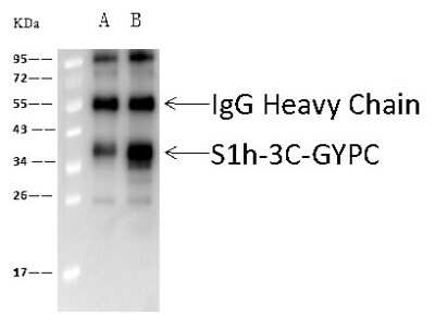 Immunoprecipitation: Glycophorin C Antibody [NBP2-97086]