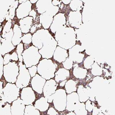 Immunohistochemistry-Paraffin: Glycosyltransferase-Like 1B Antibody [NBP2-30370]