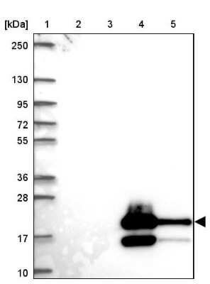 Western Blot: Glycosyltransferase-Like 1B Antibody [NBP2-30370]
