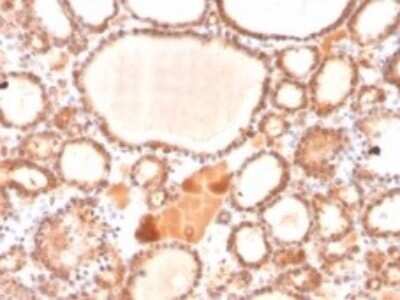 Immunohistochemistry-Paraffin: Glyoxalase I Antibody (CPTC-GLO1-1) [NBP3-07311]