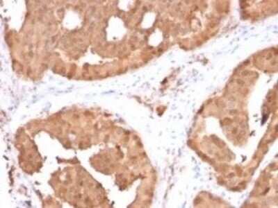 Immunohistochemistry-Paraffin: Glyoxalase I Antibody (CPTC-GLO1-1) - Azide and BSA Free [NBP3-08555]