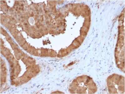 Immunohistochemistry-Paraffin: Glyoxalase I Antibody (CPTC-GLO1-3) - Azide and BSA Free [NBP3-08556]