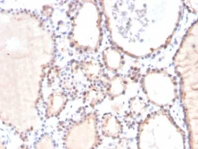 Immunohistochemistry-Paraffin: Glyoxalase I Antibody (CPTC-GLO1-3) - Azide and BSA Free [NBP3-08556]