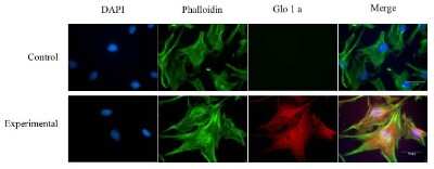 Immunocytochemistry/ Immunofluorescence: Glyoxalase I Antibody (Glo1a) [NBP1-19015]