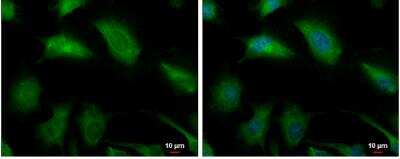 Immunocytochemistry/ Immunofluorescence: Glyoxalase I Antibody [NBP1-31466]
