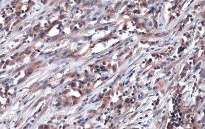 Immunohistochemistry-Paraffin: Glyoxalase I Antibody [NBP1-31466]