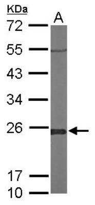 Western Blot: Glyoxalase I Antibody [NBP1-31466]