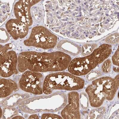 Immunohistochemistry-Paraffin: Glyoxalase II/HAGH Antibody [NBP2-38909]