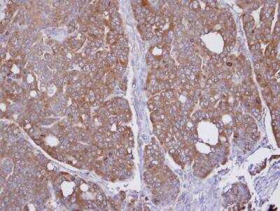 Immunohistochemistry-Paraffin: Glyoxalase II/HAGH Antibody [NBP1-33764]