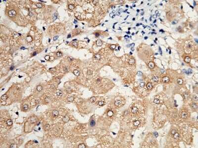 Immunohistochemistry-Paraffin: Glyoxalase II/HAGH Antibody [NBP2-99941]