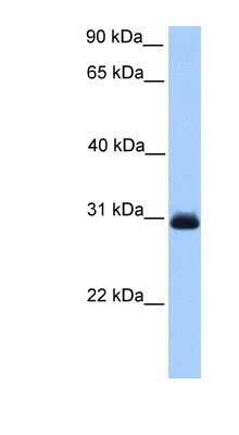 Western Blot: Glyoxalase II/HAGH Antibody [NBP1-56760]