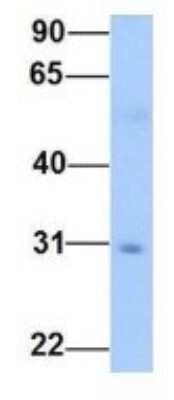 Western Blot: Glyoxalase II/HAGH Antibody [NBP1-56760]
