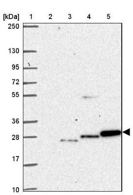Western Blot: Glyoxalase II/HAGH Antibody [NBP2-38909]