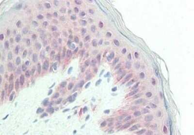 Immunohistochemistry: Glypican 1 Antibody [NBP1-42718]
