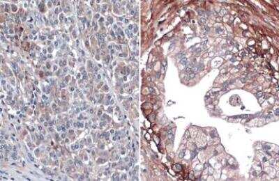 Immunohistochemistry-Paraffin: Glypican 1 Antibody [NBP1-33197]