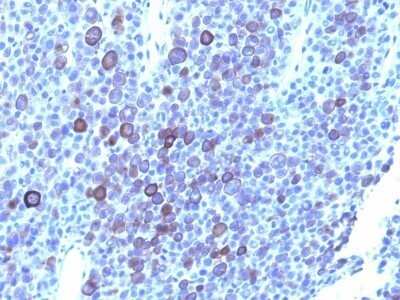 Immunohistochemistry-Paraffin: Glypican 3 Antibody (1G12 + GPC3/863) - Azide and BSA Free [NBP2-47763]