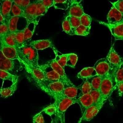 Immunocytochemistry/ Immunofluorescence: Glypican 3 Antibody (1G12) - Azide and BSA Free [NBP2-47760]