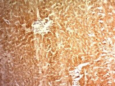 Immunohistochemistry-Paraffin: Glypican 3 Antibody (1G12) [NBP2-44484]
