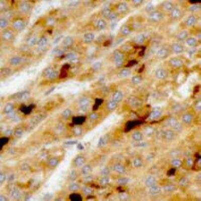 Immunohistochemistry-Paraffin: Glypican 3 Antibody (1G12) [NBP2-44484]